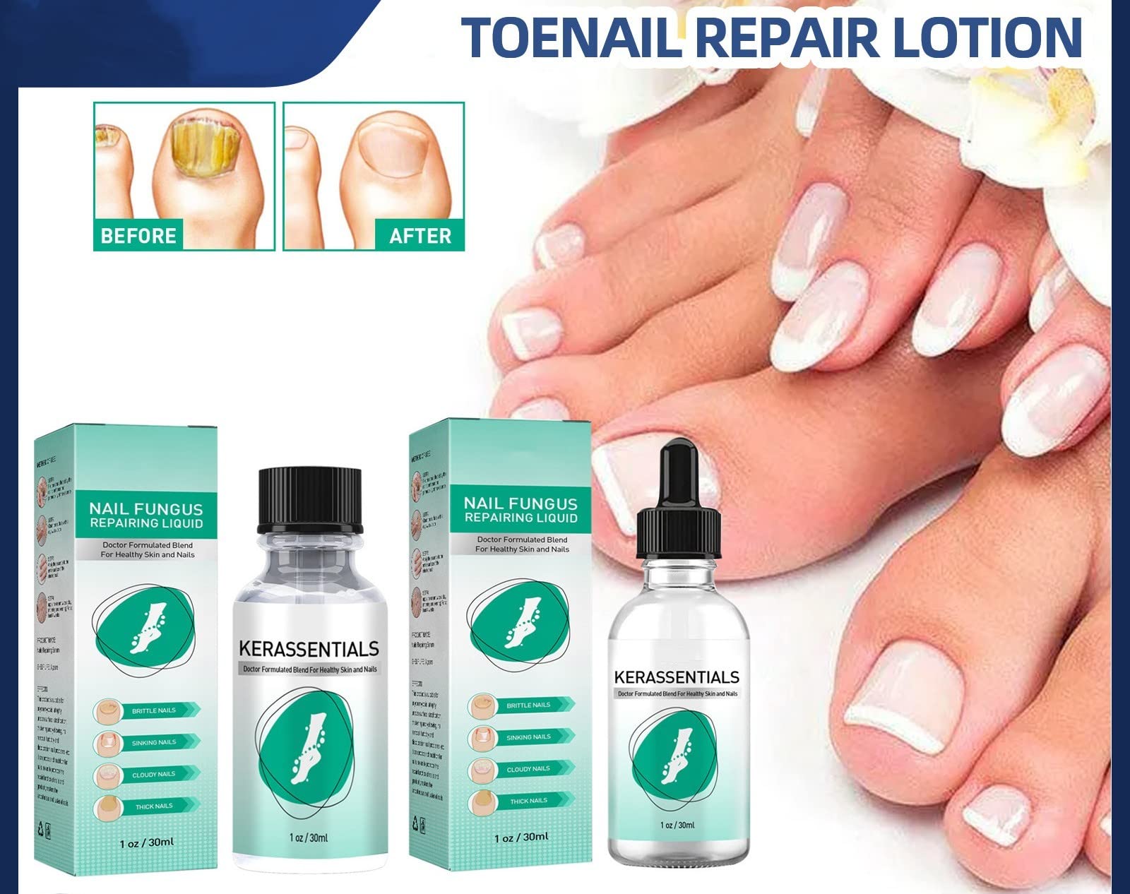 Fungal nail and foot care photo